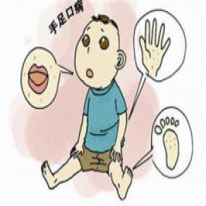 山东超两万儿童中招 高温天这种传染病家长不能掉以轻心