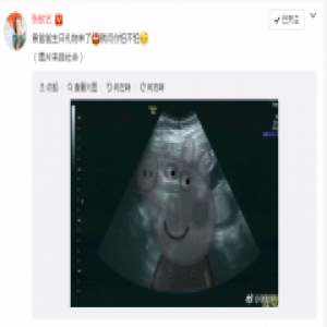 张歆艺大方公布怀孕喜讯 圈内好友排队送祝福