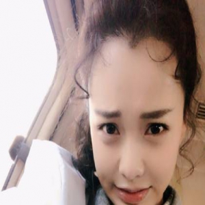 黄一琳忙里偷闲晒六连拍 网友：大脑门琳的日常