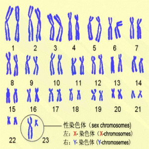 15岁女孩比同龄人矮一个头 原因竟是少了条染色体