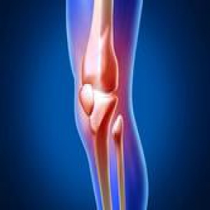 骨质增生外敷防治