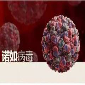 【园长篇】疑似诺如病毒暴发，深圳一幼儿园44人不适！教你正确预防预处理！