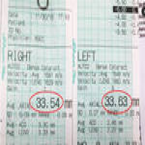 四川一老人两眼近视2700度 分不清糖盐看不清站牌