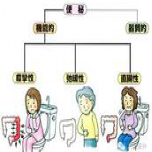 医学常识｜“五花八门”的便秘