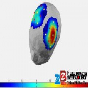 通过读心设备，渐冻症晚期患者能够表达“是”与“否”