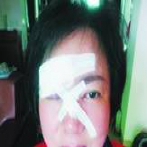 共享单车理赔首案：刹车失灵女子摔破脸