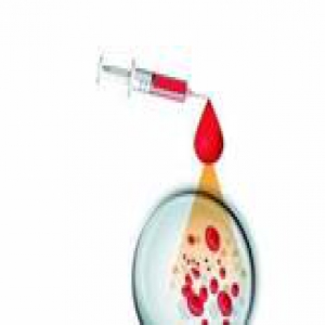 一滴血测天赋性格姻缘？专家：基因检测不能算命