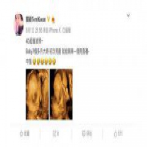 关颖晒三胎宝宝 超音波照居然在竖中指